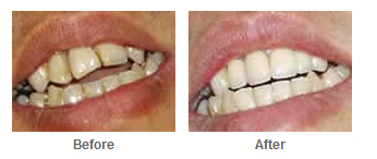Cosmetic Treatment Cosmetic Treatment